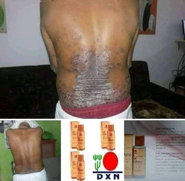 DXN Gano Massage Oil 75ml (Genuine 100) Lazada