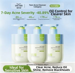 VETES | Oil Control and Acne Fighting Facial Cleanser
