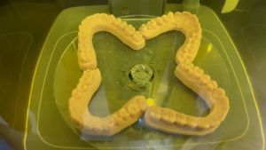 Nhựa in 3d resin mô hình phục hồi nha khoa ESUN DM100 Dental Restoration Model Resin 500ml/ Chai