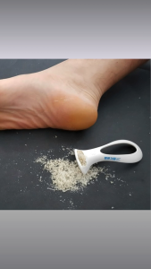 Balgasm Safe Heel Callus Remover – 1 Pack Stainless Steel Exfoliator for Smooth Feet Ergonomic Grip Durable & Safe