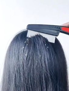 Lice Remover Comb Lice Cleaner Comb Painless Comfortable Hair Health Black Stainless Steel Needle Comb