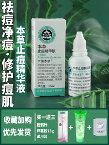 Acne Treatment Essence Liquid Aloe Vera Chinese Herbal Medicine Brightening Skin Repairing Oil Control for Oily Skin 30ml