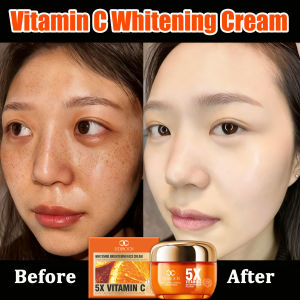 5 Heavy Vitamin C Whitening Brightening Face Cream Niacinamide Freckle Cream Brightening Skin Tone Anti-Aging Lightening Dark Spots Moisturizing Nourish Cream 50g