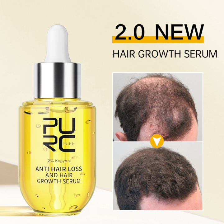Purc Natural Ginger Hair Serum Hair Grower Fast Long Hair Treatment Purc Natural Ginger Hair Serum Hair Grower Fast Long Hair Treatment
