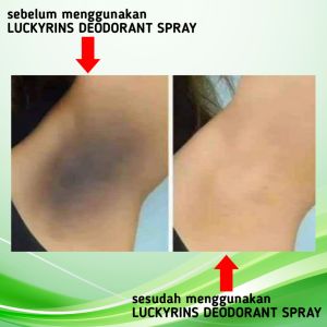 PERAWATAN KETIAK PEMBERSIH KETIAK DAN PEMUTIH KETIAK