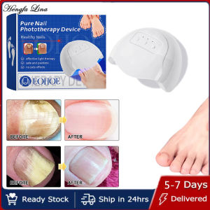 Hengfa Lina Fungal Nail Laser Device Repair Fast Nails Fungus Onychomycosis Repair Toenail Fingernail Removes Nail Fungus Foot Care Device