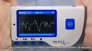 Baru mudah alih tanpa wayar Electrocardiograph Monitor Handheld PC perisian kadar jantung ECG Monitor ujian ECG pemantauan untuk penjagaan rumah