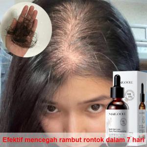 Serum Penumbuh Rambut Obat Penumbuh Rambut Botak Minyak Rambut Penumbuh rambut botak 60ML penumbuh danperawatanPenumbuh Rambut Secara Cepat Penyubur Rambut Rontok Pria Wanita Mencegah Kebotakan