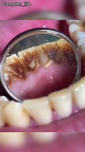 Scoban Toothpaste Peppermint & Baking Soda Teeth Whitening: A Comprehensive Guide