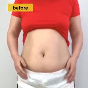 Nanjing Tongrentang Ai Cao Tie slimming patch for weight loss detoxification rapid slimming and weight loss products detoxification traditional Chinese medicine weight loss protection abdominal wet body slimming 12 tablets