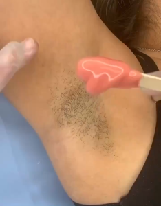 JM เม็ดแว๊กซ์ กำจัดขน ชุดแว๊กซ์ขน แว็กซ์กำจัดขน ละลายไว มีหลายกลิ่นให้เลือก 100g/300g/500g