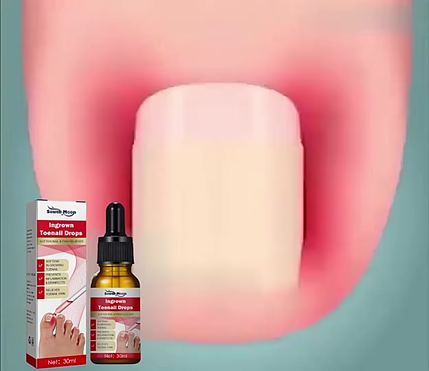Ubat Kuku Rosak Ingrown Drops Nail Repair Serum Nail Fungus Treatment Ubat Kuku Cekam Toenail Corrector Paronychia Pain Relief 10ML Nail Fungus Treatment Liquid Feet Care Essence Nail Foot Repair Toe Anti Infection