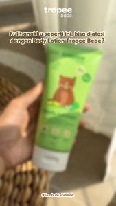 Tropee Bebe Body Lotion 150ml | Melembutkan dan Melembapkan Kulit | Skincare Bayi dan Anak / LOTION ANAK / lotion baby / lotion terlaris / p[e