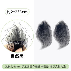 Invisible Hairline Stickers for Men M-Shaped Hair Transplant Scalp Pieces Real Hair Density Increasing Hairline Accessories
