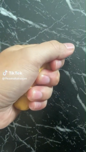 ไม้นวดมือ หนามเตย นิ้วล็อก มือชา นิ้วชา ปวดมือ พังผืดมือ ไม้นวดฝ่ามือ #ส่งตรงจากบริษัท