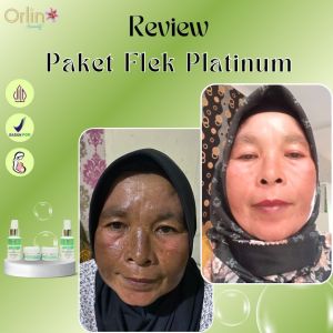 (SALE)Paket Flek Platinum BPOM OrlinBeauty//Cream Pemudar Flek
