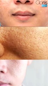 Clorismen Brightening Cream Mencerahkan Wajah Yang Kusam Dan Berminyak Skincare Perawatan Pria Untuk Mencerahkan Wajah Bebas Kusam Memutihkan Muka Dengan SPF Melindungi Dari Sinar Matahari Krim Pembersih Pemutih Kulit Wajah Pria Secara Alami Original BPOM