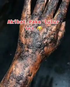 BEDAK LOTONG ORI LULUR TRADISIONAL VIRAL DI TIKTOK KHAS BUGIS BEDAK LOTONG BEDA LOTONG 45