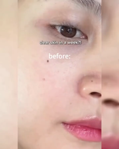 CELIMAX The Vita-A Retinal Shot Anti-Aging Tightening Booster 15ml Produk Perawatan Kulit dengan 0.1% Retinal & Teknologi A-Shot untuk Elastisitas Kulit dan Penurunan Garis Halus