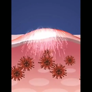 ซื้อ1แถม1! สบู่ YTL สูตรอัพเกรด ฆ่าเชื้อ ขจัดไรฝุ่น พืชธรรมชาติ บำรุงผิว