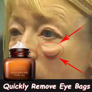 Fat granule eyebags remover Eye cream panda eyes eye dark circle remover eye wrinkle cream remove repair fat particle Krim mata eye cream for anti aging