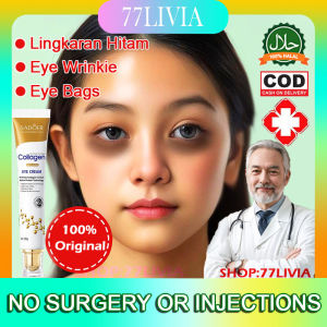 Krim Mata Collagen 20G: Solusi Melawan Lingkaran Hitam & Kantung Mata