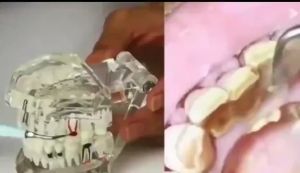 Water Flosser 100% ไหมขัดฟันพลังน้ำพกพาสะดวก เปลี่ยนเครื่องฟรี 21วัน 5 ชั่วโมง