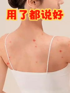 Back acne spray body acne spray antibacterial spray remove mites acne marks remove back acne 60ml gentle cleansing remove acne marks remove mites back