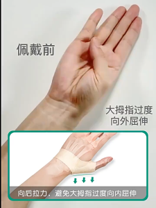 Elastic Thumb Protection Tenosynovitis Breathable Arthritis Sprain Relieving Pain Thumb Cover Mouse Hand