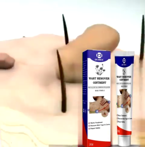 Kem mụn thịt dư cao cấp Ouhoe  Kem tẩy nốt ruồi mụn thịt dư nốt ve chó u mềm treo