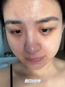 RUYI | Oily Skin Acne Fighting & Blackhead Removal Face Cleanser