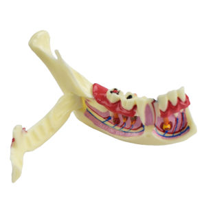 Dental Model Mandible & Gums Decomposition: A Comprehensive Guide