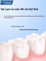 SUPER DEER | Nước Súc Miệng Tươi Hơi Thở Dễ Mang Theo. 