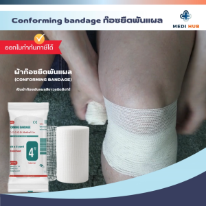 Conforming Bandage (ยกกล่อง 12 ม้วน) ผ้ายืดพันแผล ปิดแผล ขนาด 2 3 4 6 นิ้ว