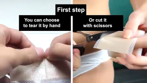 Medical Scar Patch Silicone Skin Repair Tape Sticker for Pregnancy Surgery Scar Removal 4*150cm