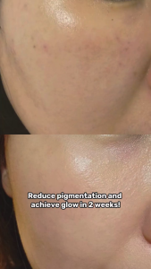 But Better Beauty | 2-in-1 Dual Vitamin C + Niacinamide Serum | Fade Dark Spots Acne Scars Pores