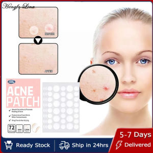 Hengfa Lina 72/144/216Pcs Invisible Acne Patches Removal Pimple Anti-Acne Hydrocolloid Patches Spots Marks Concealer Repair Sticker Waterproof