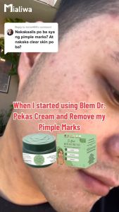 Blem Dr The Ultimate Pekas Cream & Toner Whitening Exfoliating Rejuvenating Moisturizer Face Cream Beauty Skin Care Niacinamide Aloe Vera Calamansi Dark Spot Melasma Freckles Pore Pimple Acne Blackheads Oil Control Anti Aging Glass Skin For Men & Women