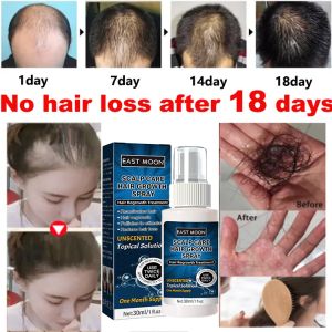 7 days Hair Growth Essence Hair Treatment Hair Tonic Conditioner Hair Anti Hair Loss Treatment Fast Promotes Hair Growth For man and woman 生发精华 30ML
