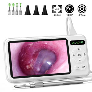 Digital Otoscope Video Ear Camera 4.5 IPS Screen 3.9MM Lens Ear Picker With 6LEDs Ear Wax Removal Tool Ear Cleaning Stick