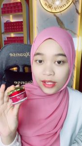 Paket Flek RDN Beauty: Day & Night Cream untuk Mengecilkan Flek Hitam