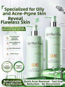 VETES | Amino Acid Oily Skin Acne Deep Clean Shrink Pores Facial Cleanser