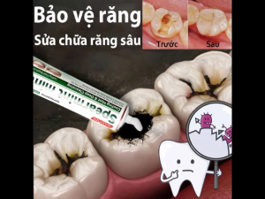 Kem đánh răng chống sâu răng kem đánh răng làm trắng răng kem đánh răng loại bỏ cao răng chống sâu răng làm sạch răng miệng sửa chữa nướu tổn thương cho răng trắng sáng