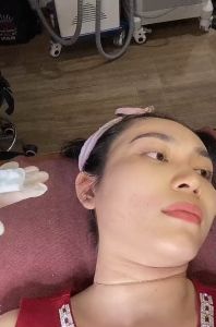 Kim 5 kim 9 sử dụng cho máy tinh chất Ammi Ez Injector