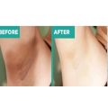 NEI PEELING SPRAY / PERONTOK DAKI / PEMBERSIH KULIT 90ML. 