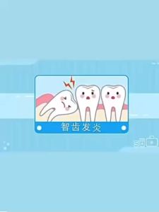 Penurunan Menaikkan Tingkat Gigi Profesional Yang Ditargetkan 20 ML Yang Ditargetkan Untuk Memblokir Neuralgia Secara Efektif Meningkatkan Kemacetan Gingiva Dan Pembengkakan