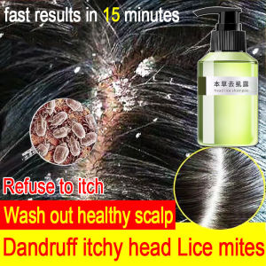 Lice are Gone: Lice Removal Shampoo for Kids, Free Shower Cap, Grate Comb, Anti-Lice Shampoo, Dandruff Treatment, and Scalp Care