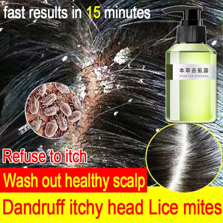 【Lice are gone】lice removal shampoo for kids free shower cap grate comb anti lice shampoo
