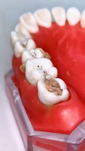 Dental floss benang Busur tusuk gigi Macromolecul carea pembersih sela gigi isi 50 pcs LBX Lerch Flosser Toothpick - PGC SHOP