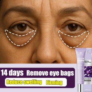 Eye Cream for Dark Circles eye bag remover eye care Anti Aging Remove Fine Lines Fat Particles Krim mata Brightening 眼霜
